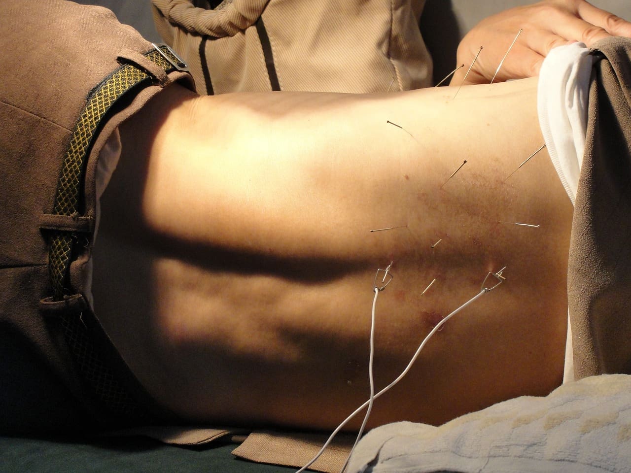 Can Acupuncture Improve Fertility? The Truth Unveiled Can Acupuncture Improve Fertility? The Truth Unveiled