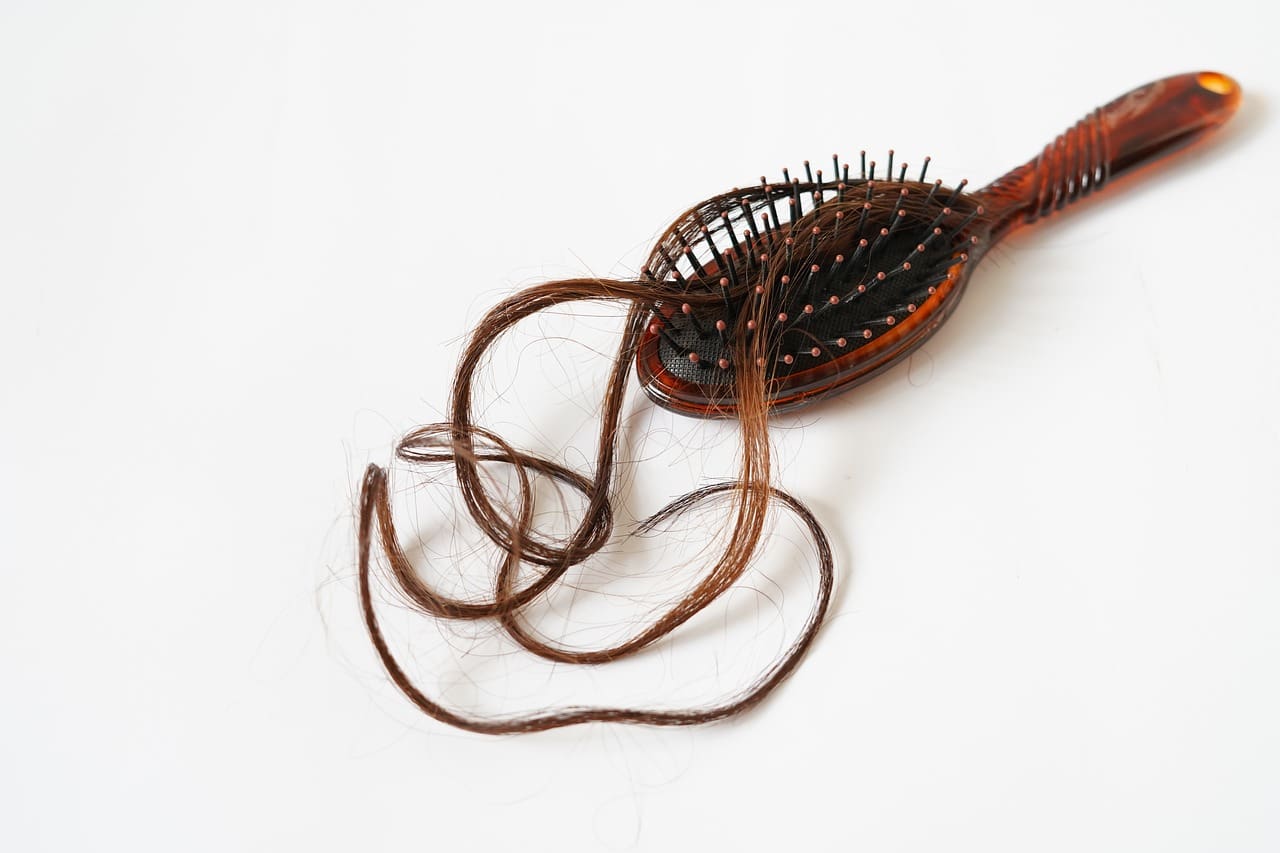 Hair Loss Chronicles: Real-Life Stories of Overcoming Challenges Hair Loss Chronicles: Real-Life Stories of Overcoming Challenges