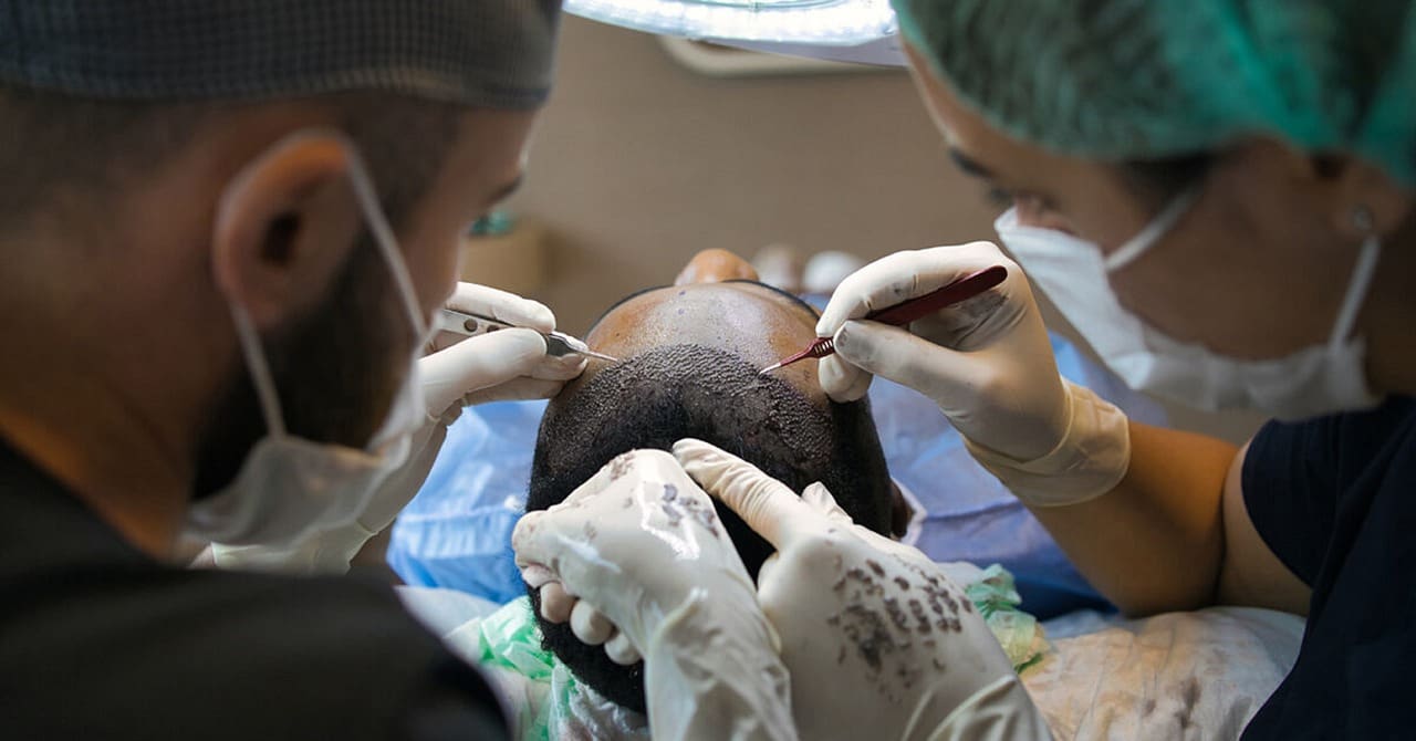 The Truth About Hair Transplants: Benefits and Risks The Truth About Hair Transplants: Benefits and Risks
